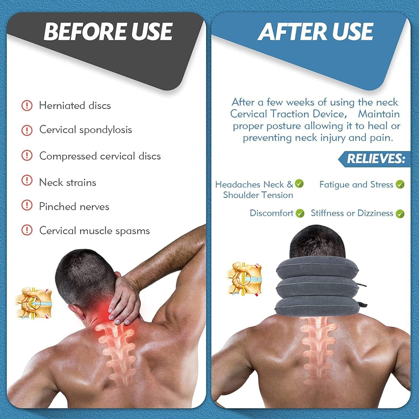 Neck Traction Device, Cervical Stretcher, Neck Support, Neck Pain Relief, Posture Corrector